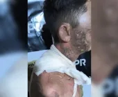 Mulher é presa após jogar panela de água fervendo em homem, em Palotina